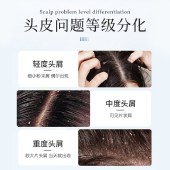 【VIP秒杀】【头屑轻松搞定】国药集团天目湖二硫化硒去屑洗发露 300ml/盒 去屑洗发水净屑痒-副本446