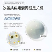 【VIP秒杀】【头屑轻松搞定】国药集团天目湖二硫化硒去屑洗发露 300ml/盒 去屑洗发水净屑痒-副本446