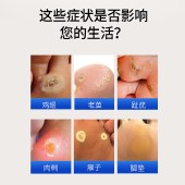【鸡眼趾疣】白云山鸡尤康贴鸡眼贴肉刺脚丁底祛鸡眼膏跖尤瘊死皮老茧子足部脚垫12贴/盒
